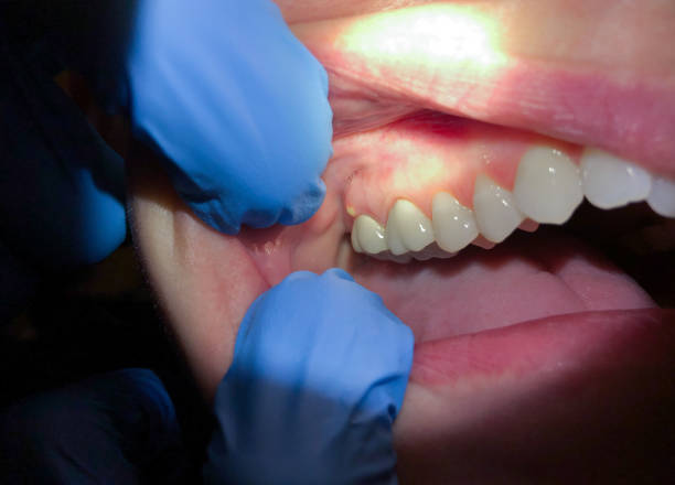 Best Cosmetic Emergency Dentistry in Moose Wilson Road, WY