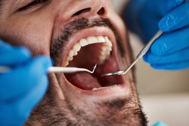 Best Urgent Care for Lost Fillings or Crowns in Moose Wilson Road, WY